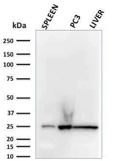 Anti-C1QA Antibody [C1QA/2783]