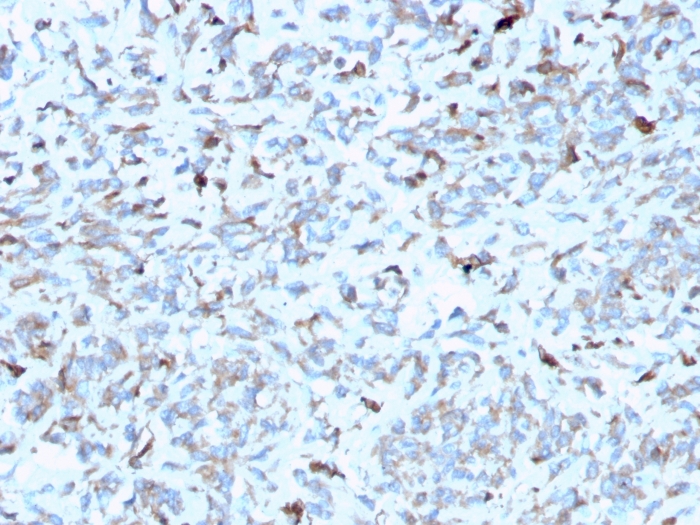 Anti-C1QA Antibody [C1QA/2952]