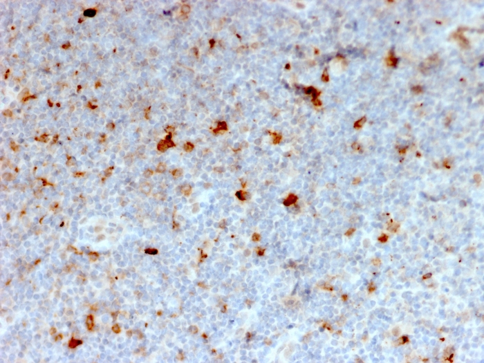 Anti-CD134 Antibody [OX40/2721]