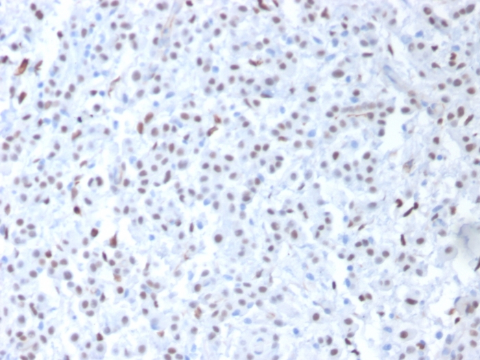 Anti-Wilms Tumor Protein Antibody [6F-H2]