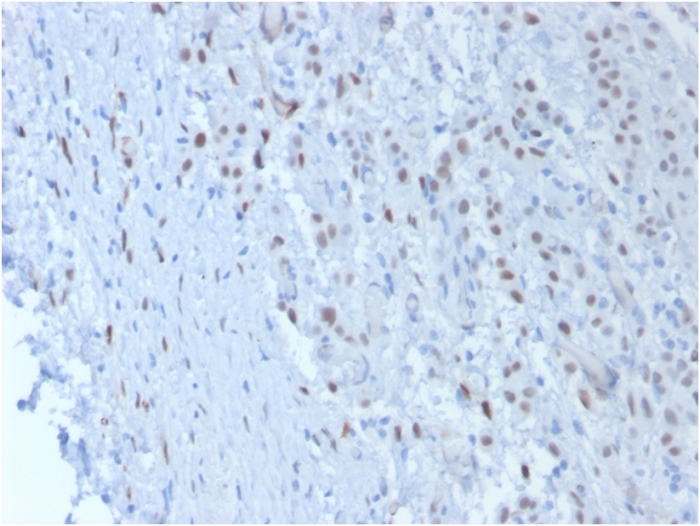 Anti-Wilms Tumor Protein Antibody [SPM361]