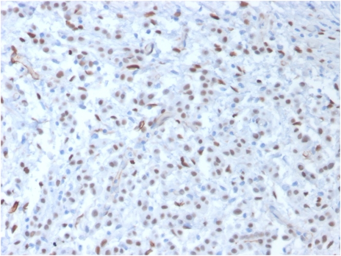 Anti-Wilms Tumor Protein Antibody [WT1/857]