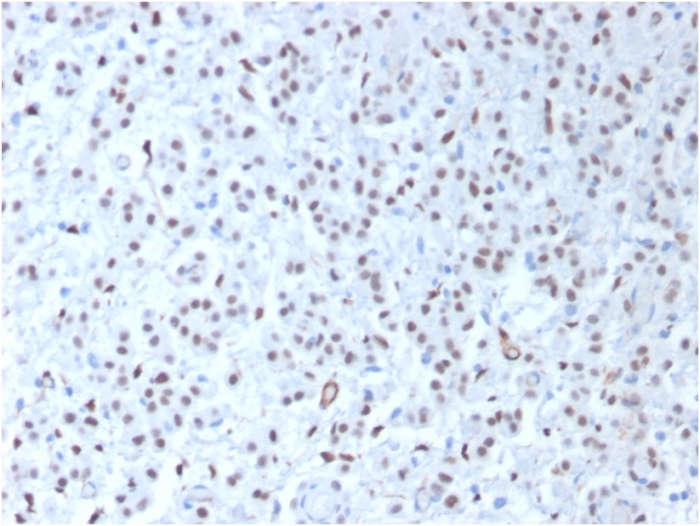 Anti-Wilms Tumor Protein Antibody [WT1/1434R]