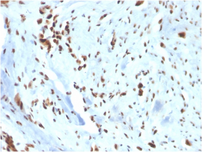 Anti-Wilms Tumor Protein Antibody [WT1/3477R]