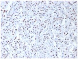 Anti-Wilms Tumor Protein Antibody