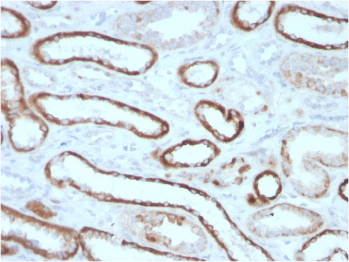 Anti-Carbonic Anhydrase IX Antibody [CA9/3405]