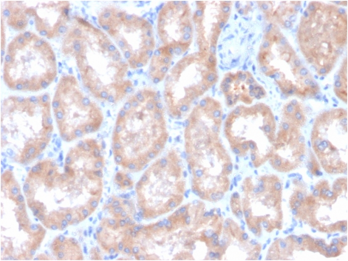 Anti-Carbonic Anhydrase IX Antibody [CA9/3407]