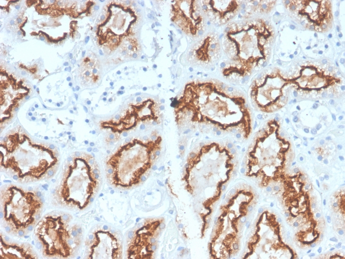 Anti-Carbonic Anhydrase IX Antibody [CA9/2993R]