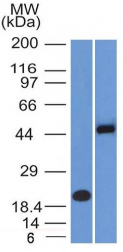 Anti-PAX8 Antibody [PAX8/1491 + PAX8/1492]