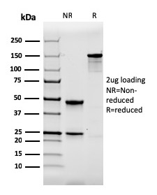 Anti-Calbindin Antibody [CALB1/2364]