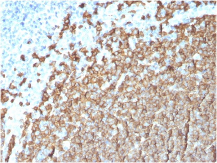 Anti-CD20 Antibody [MS4A1/3411]
