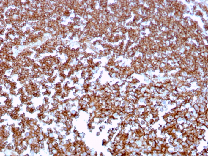 Anti-CD20 Antibody [MS4A1/3409]