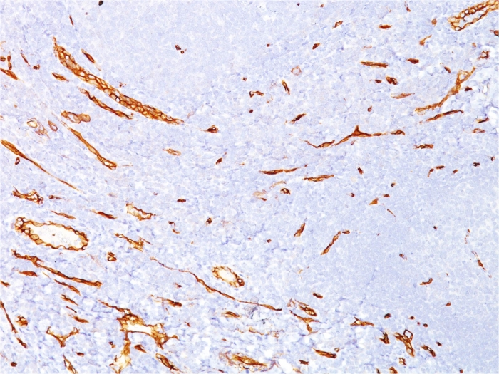 Anti-CD34 Antibody [QBEnd/10]