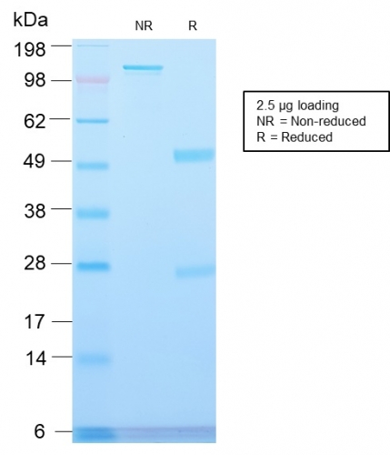 Anti-Major Vault Protein Antibody [VP2897R]