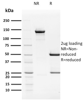 Anti-HPV16 E2 Antibody [TVG 261]