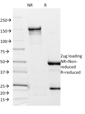 Anti-Borrelia burgdorferi p41 Flagellin Antibody [6802]