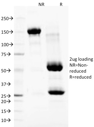 Anti-Nuclear Membrane Antibody [NM97]