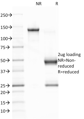 Anti-EBV Latent Membrane Protein 1 Antibody [CS1]