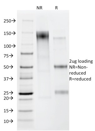 Anti-Helicobacter pylori Antibody [HP/212]
