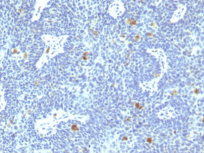 Anti-HPV16 E6 Antibody [HPV16/1295]