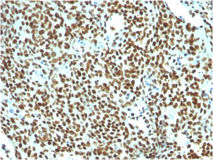 Anti-Nuclear Antigen Antibody [NM106]