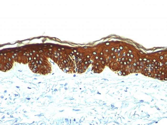 Anti-Keratin 76 Antibody [AE-3]