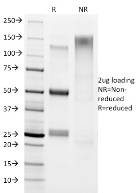 Anti-Helicobacter pylori Antibody [HP/1336]