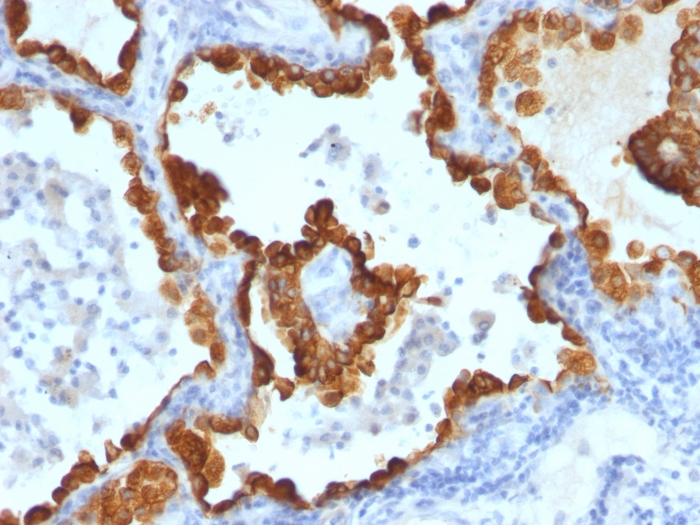 Anti-Cytokeratin 8 + 18 Antibody [C-43 + DC10]