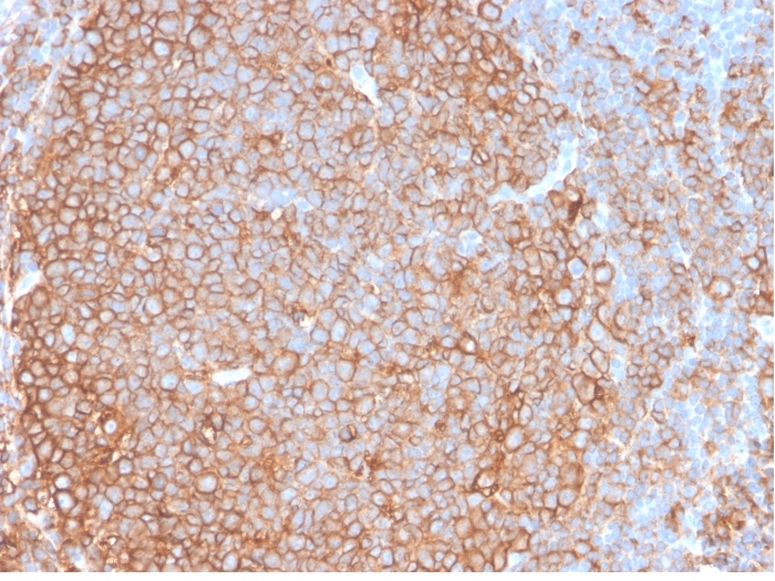 Anti-HLA DP + DQ + DR Antibody [HLA-Pan/2967R]