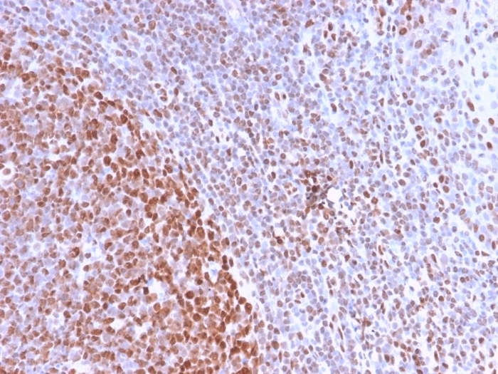 Anti-Nuclear Antigen Antibody [NM2984R]