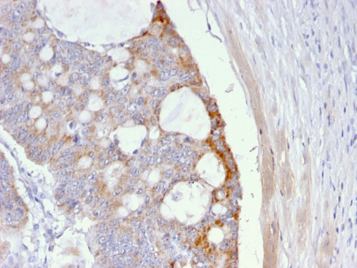 Anti-Thomsen-Friedenreich Antigen Antibody [A63-C/A9]