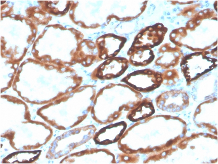 Anti-Cadherin 16 Antibody [CDH16/2125] (Biotin)
