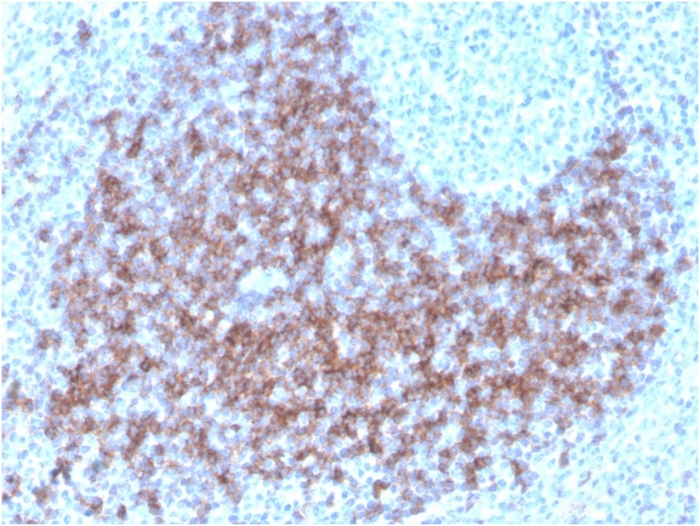 Anti-CD23 Antibody [FCER2/3592] (Biotin)