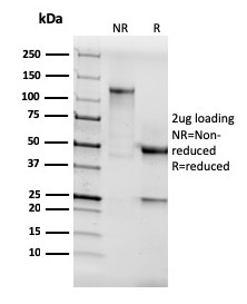 Anti-AKT1 Antibody [AKT1/3898R] - BSA and Azide free