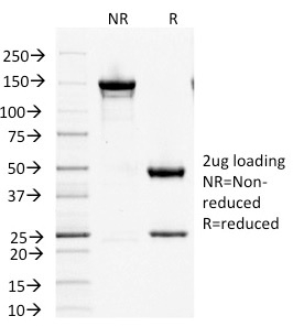 Anti-Factor XIIIa Antibody [F13A1/1447] - BSA and Azide free