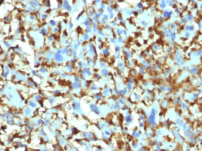 Anti-Factor XIIIa Antibody [F13A1/1448] - BSA and Azide free