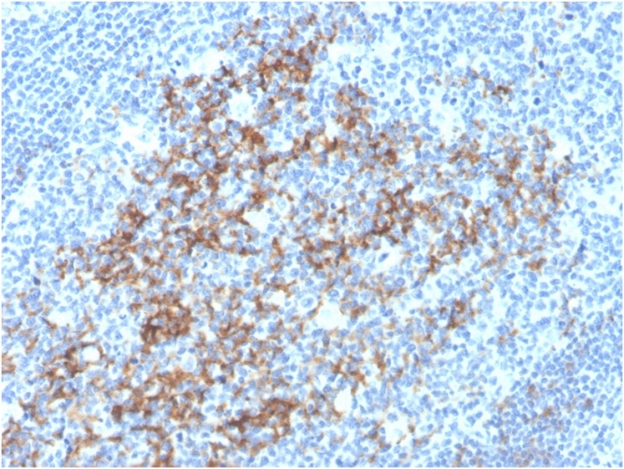 Anti-CD23 Antibody [FCER2/3592] - BSA and Azide free