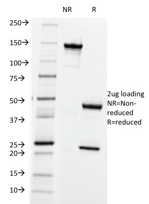 Anti-HLA ABC Antibody [SPM419] - BSA and Azide free