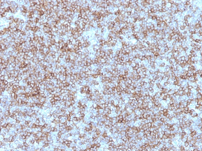 Anti-HLA DP + DR Antibody [Bra-14] - BSA and Azide free