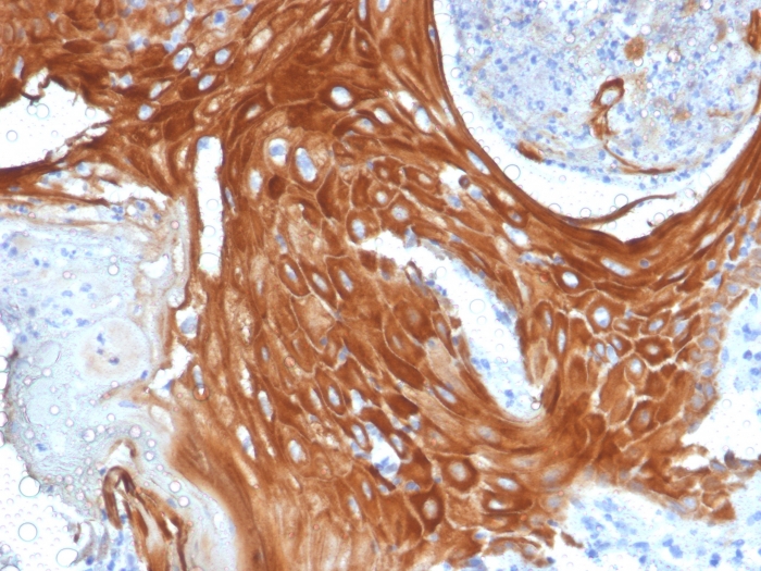 Anti-Cytokeratin 6A Antibody [KRT6A/2368] - BSA and Azide free