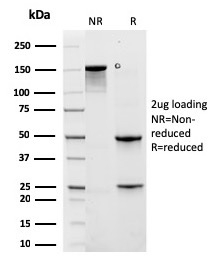 Anti-Cytokeratin 6A Antibody [rKRT6A/2100] - BSA and Azide free