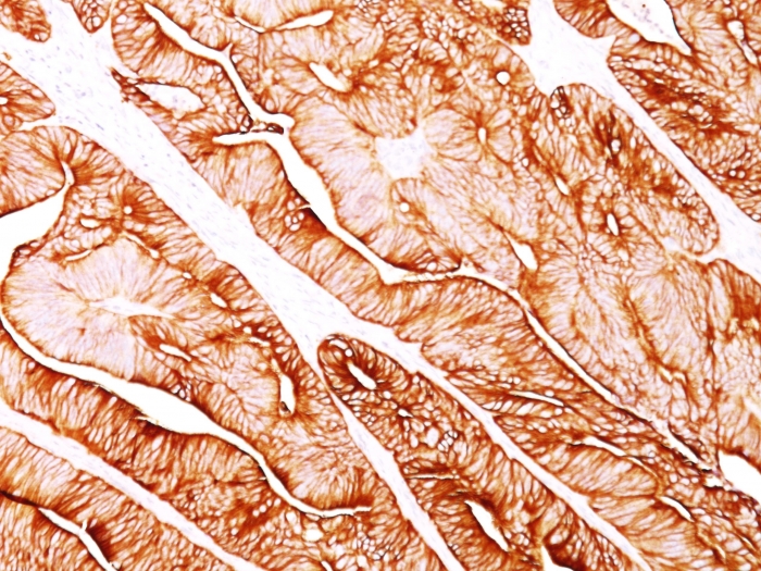 Anti-Cytokeratin 8 Antibody [H1] - BSA and Azide free