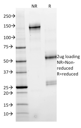 Anti-SMAD4 Antibody [SMAD4/2524] - BSA and Azide free