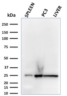 Anti-C1QA Antibody [C1QA/2783] - BSA and Azide free