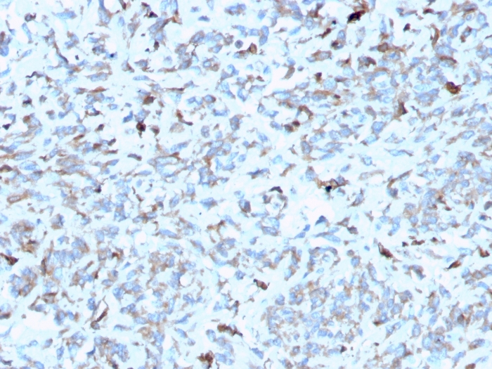 Anti-C1QA Antibody [C1QA/2952] - BSA and Azide free