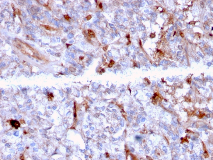 Anti-C1QA Antibody [C1QA/2956] - BSA and Azide free