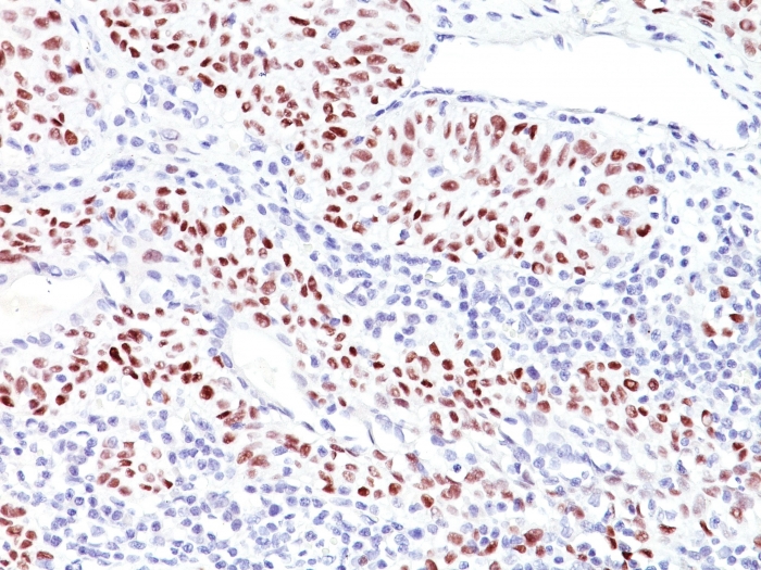 Anti-p53 Antibody [TRP/816] - BSA and Azide free