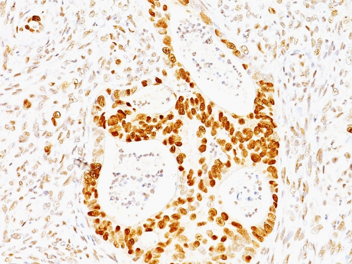 Anti-p53 Antibody [TRP/817] - BSA and Azide free