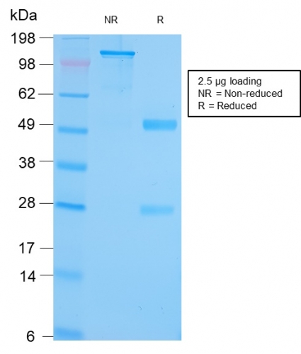 Anti-GRP94 Antibody [HSP90B1/3168R] - BSA and Azide free