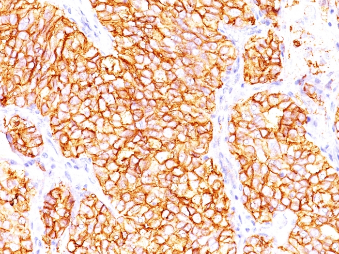 Anti-Carbonic Anhydrase IX Antibody [66.4.C2] - BSA and Azide free